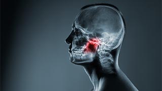 Temporomandibular Joint Disorders